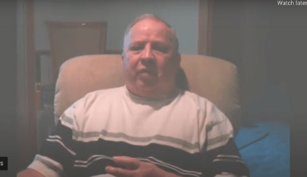 Amputation of Multiple Fingers