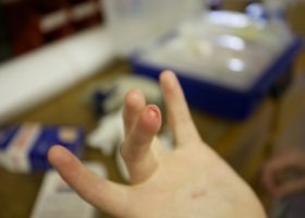 “I only had to put on a band-aid.”