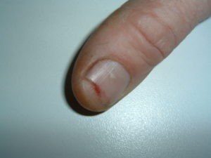 “The blade stopped immediately.”